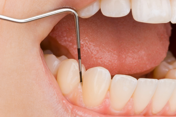 病状の改善、健康な歯の維持